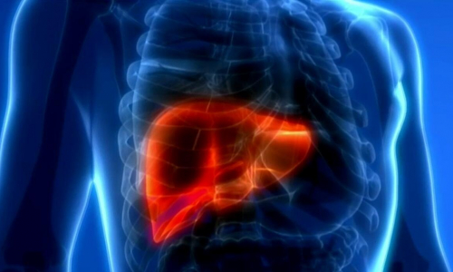 Qué es el hígado graso y cómo combatirlo